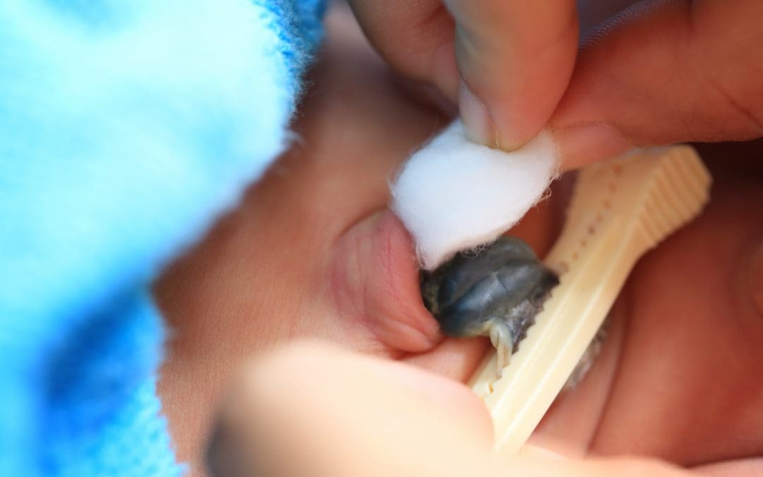 All You Need To Know About Delayed Cord Clamping. Is It Good?