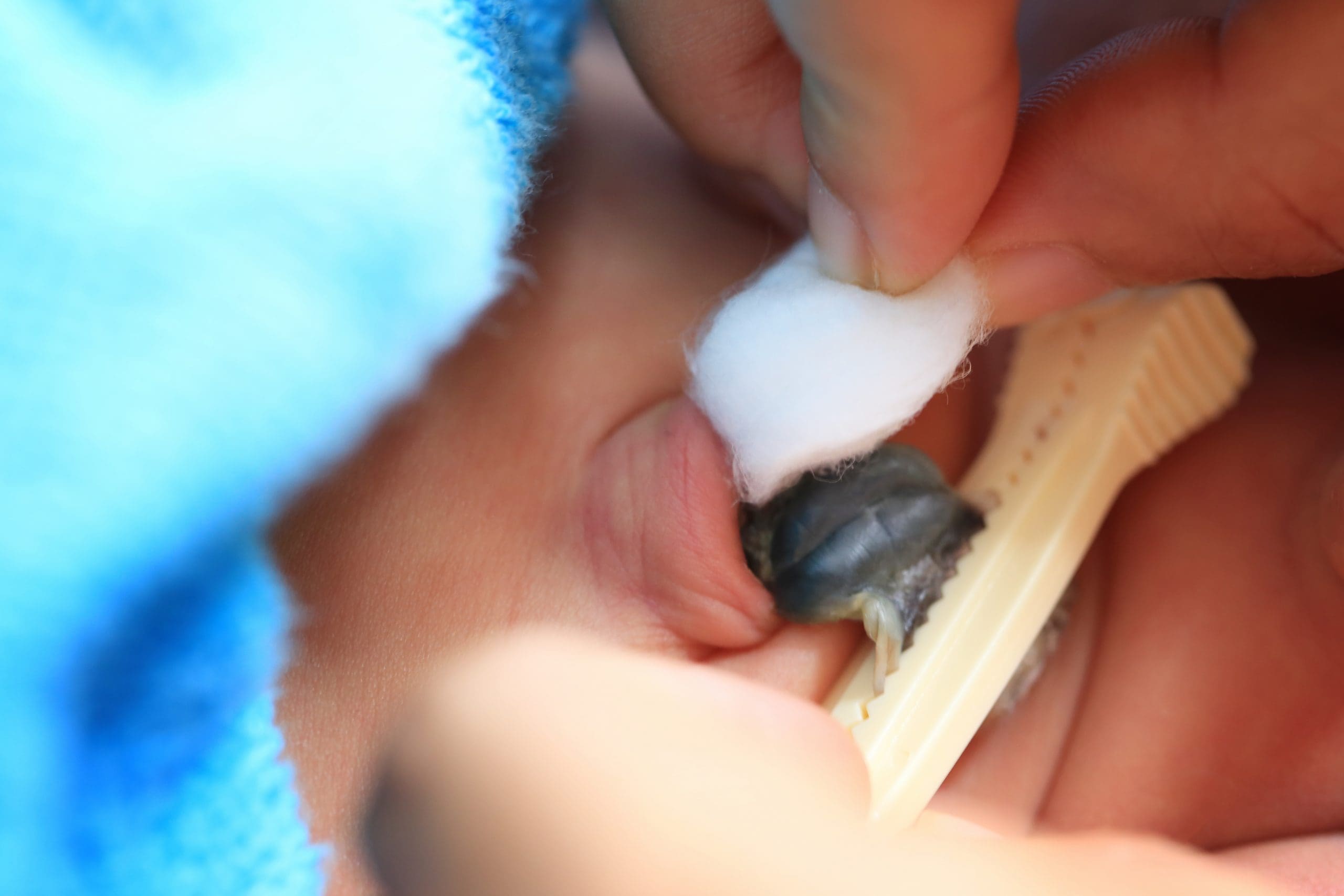 Пупок новорожденного с прищепкой. У нее отпадет что. Художник ярышкин. У нее отпадет что. У нее отпадет что.